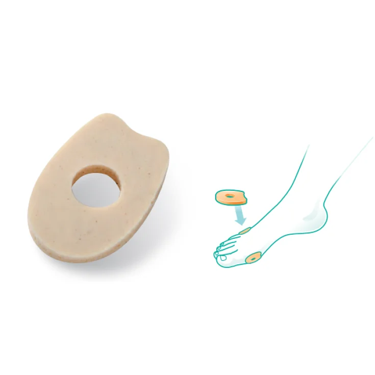 Oppo Cusc Ov Corns / calluses 6020