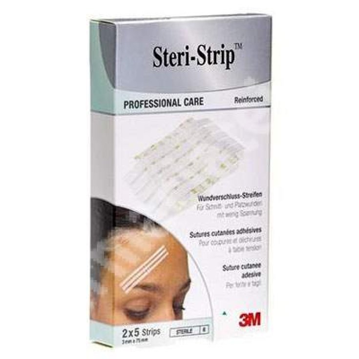 Steri-Strip 3M 3x75mm 10 Pieces