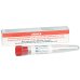 URINE TEST TUBE 12ML