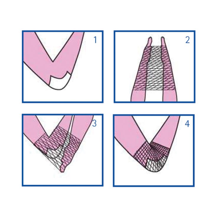 CALIB 3 ELASTIC TUBULAR NET CALIB 3 ELASTIC TUBULAR NET